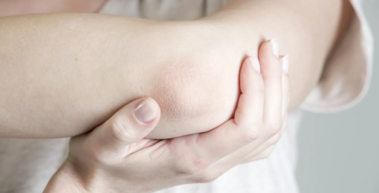 Solusi Siku Mulus: Usir Kering Dan Gatal Sekarang!