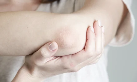 Solusi Siku Mulus: Usir Kering Dan Gatal Sekarang!