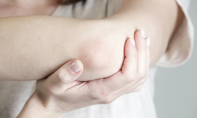 Solusi Siku Mulus: Usir Kering Dan Gatal Sekarang!