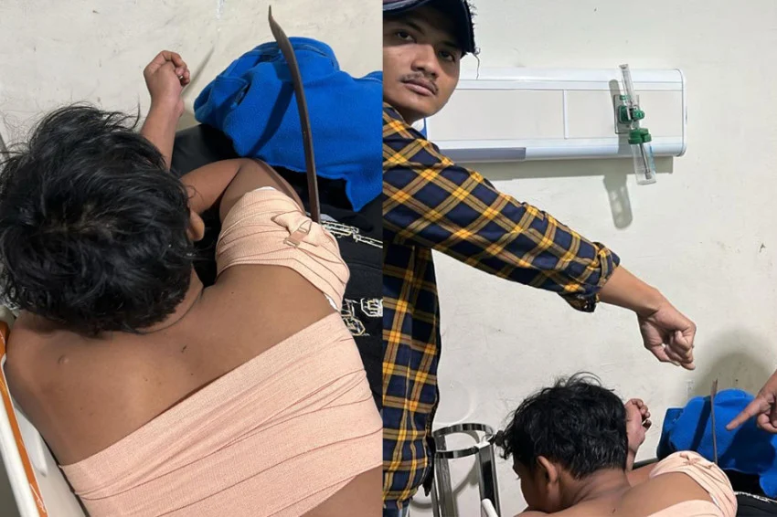 Makasar Jaktim Mencekam: 1 Korban Bacok Usai Tawuran Remaja